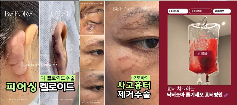 조아성형외과의원