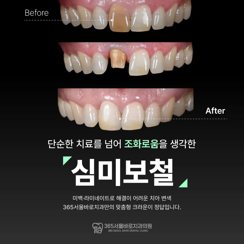 365 Seoul Baro Dental Clinic