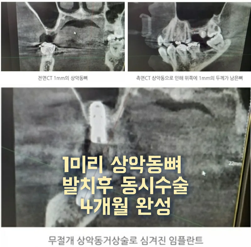 Ostone Dental Clinic