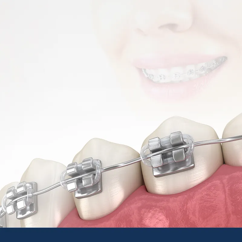 Esbo Stone Orthodontic and Dental Clinic