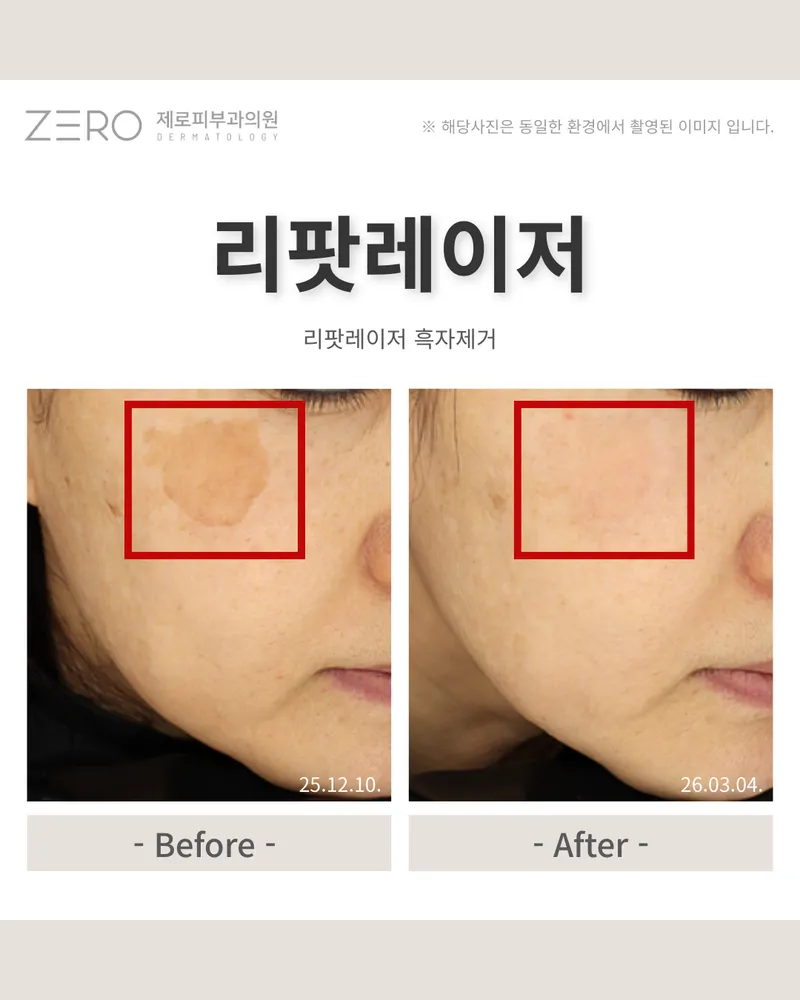 Zero Skin Clinic
