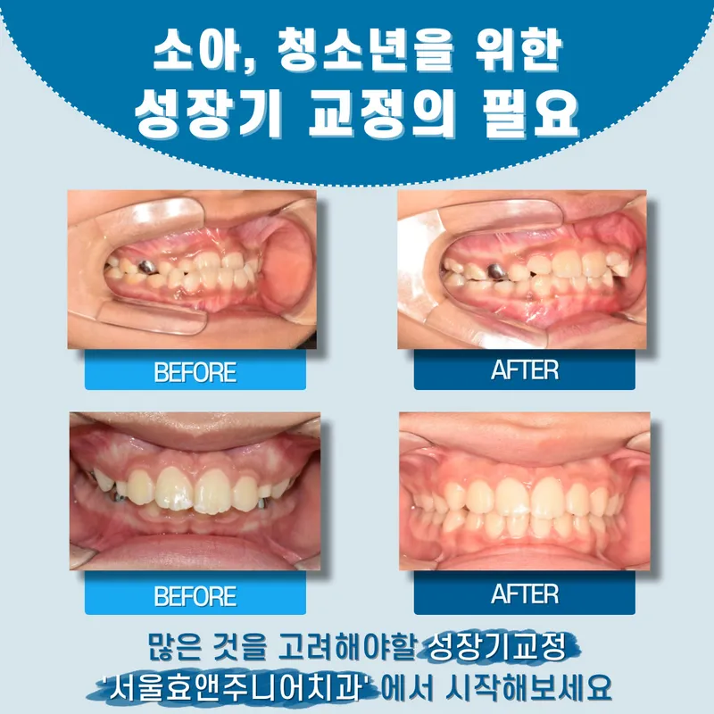 Seoul Hyo and Junior Pediatric Dentistry Clinic