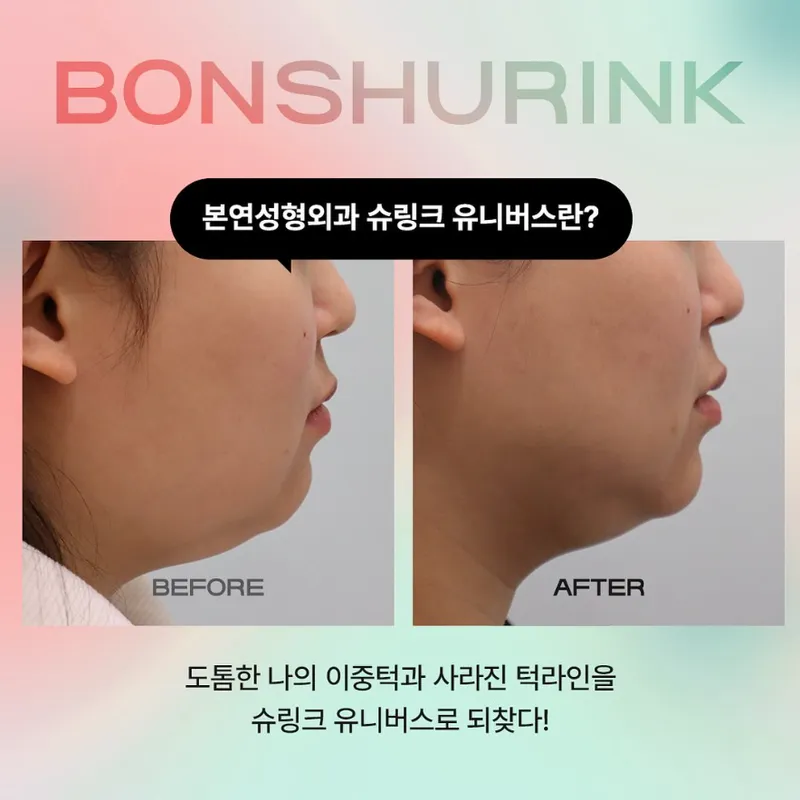 본연성형외과의원