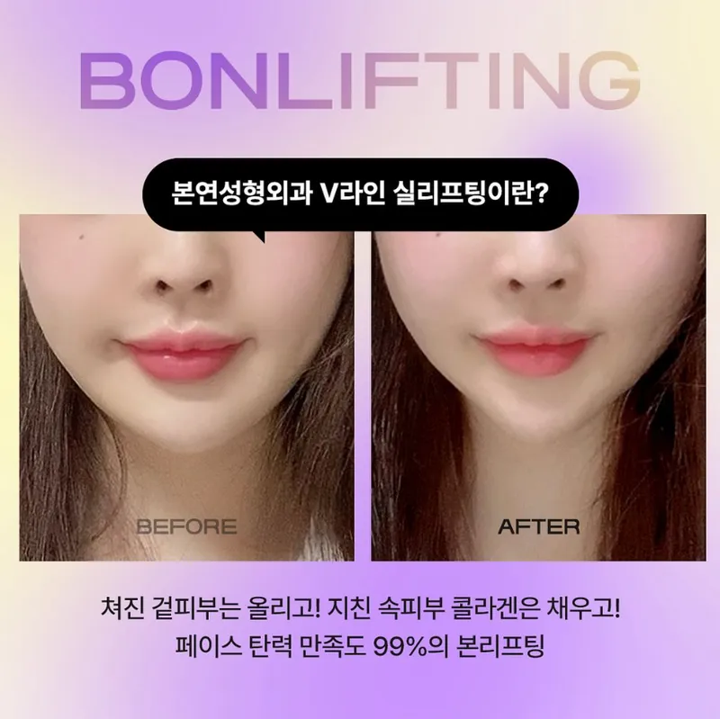 본연성형외과의원