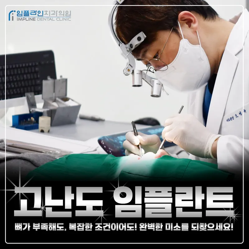 Implant Clinic Implant