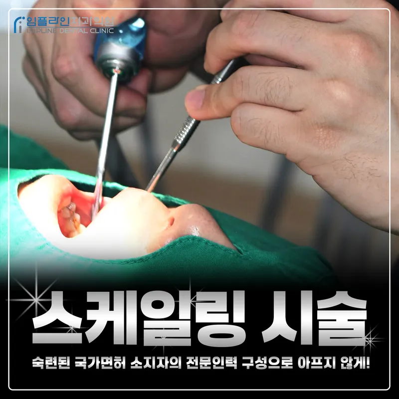 Implant Clinic Implant