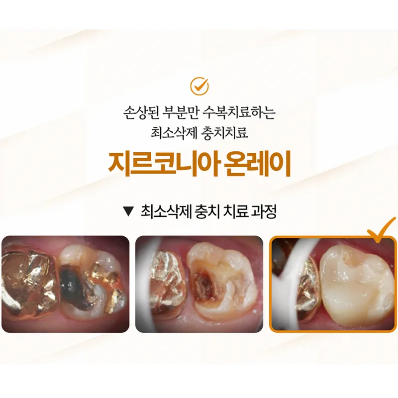 Self-Extraction Tooth Clinic Samsung Plant