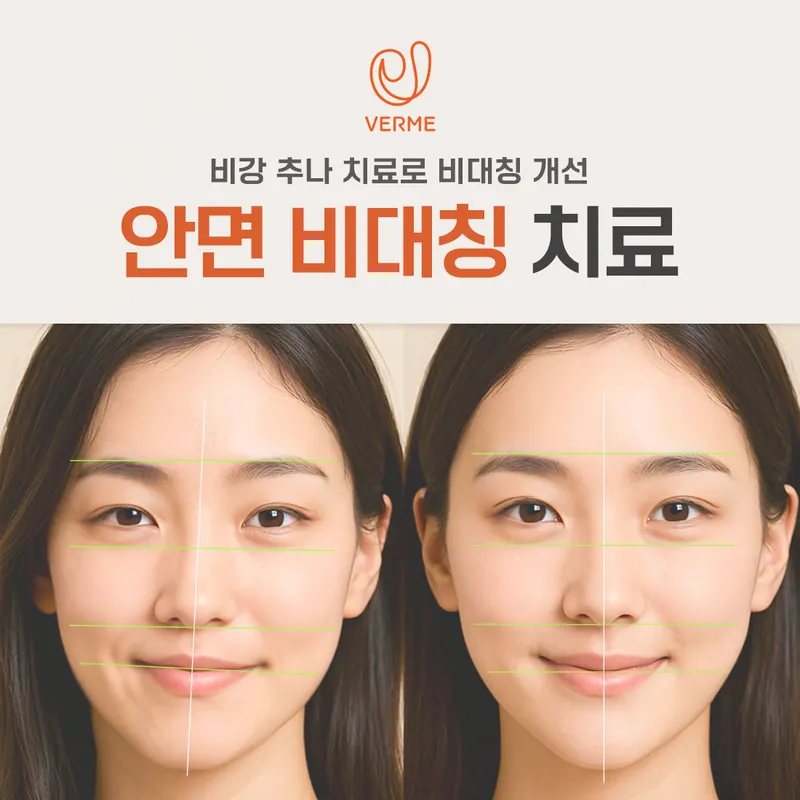 Vermy Korean Medicine Clinic Cheongdam Branch
