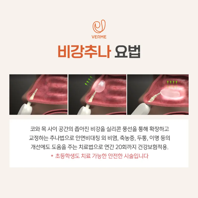 Vermy Korean Medicine Clinic Cheongdam Branch