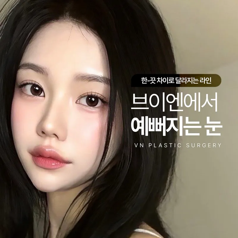 브이엔성형외과의원