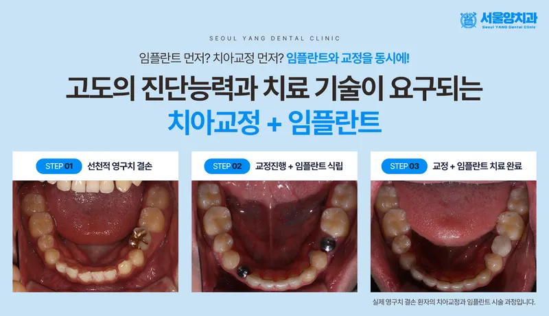 서울양치과의원 양재