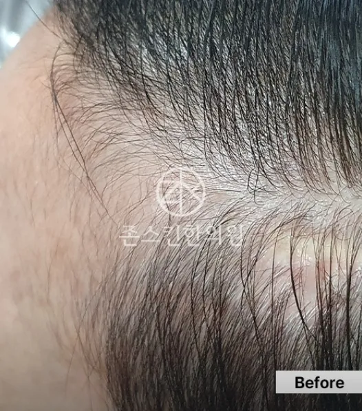 Joneskin Korean Medicine Clinic Nowon