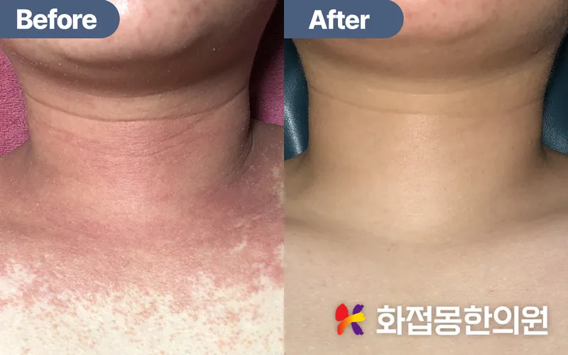 Flower Dream Korean Medicine Clinic Gangnam Main Branch
