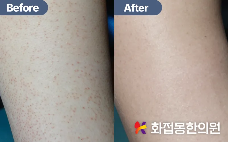 Flower Dream Korean Medicine Clinic Gangnam Main Branch
