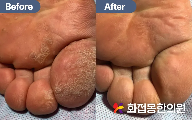 Flower Dream Korean Medicine Clinic Gangnam Main Branch