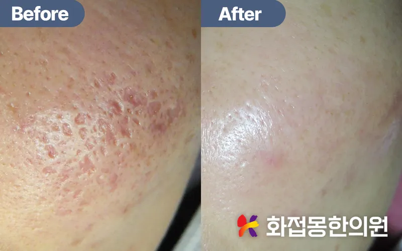 Flower Dream Korean Medicine Clinic Gangnam Main Branch