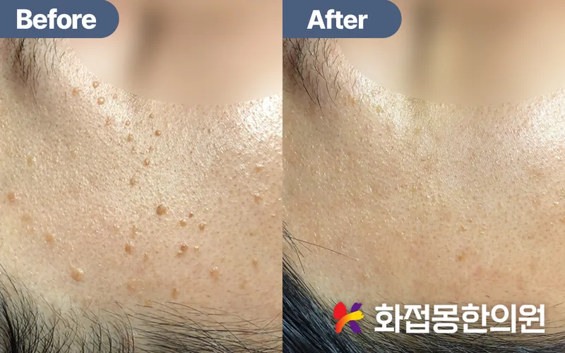 Flower Dream Korean Medicine Clinic Gangnam Main Branch