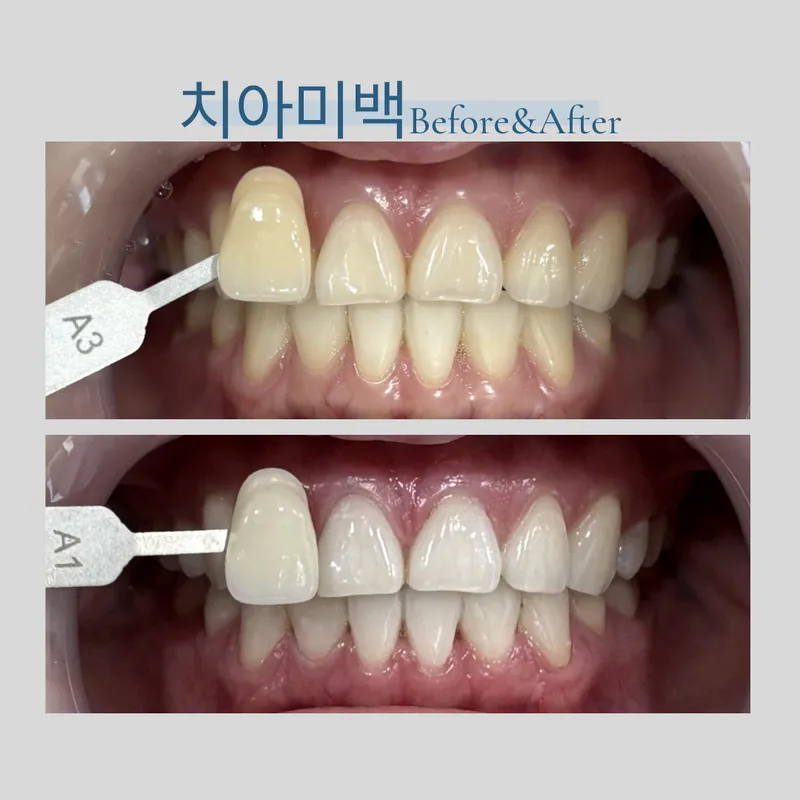 Seoul Spring Plant Dentist Clinic