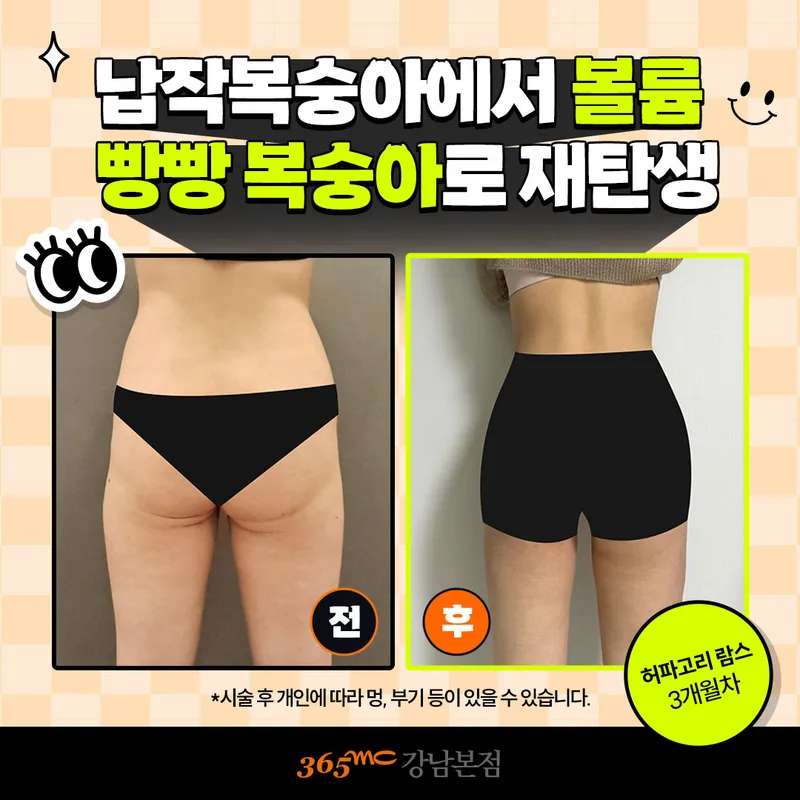 365mc Clinic Gangnam Branch