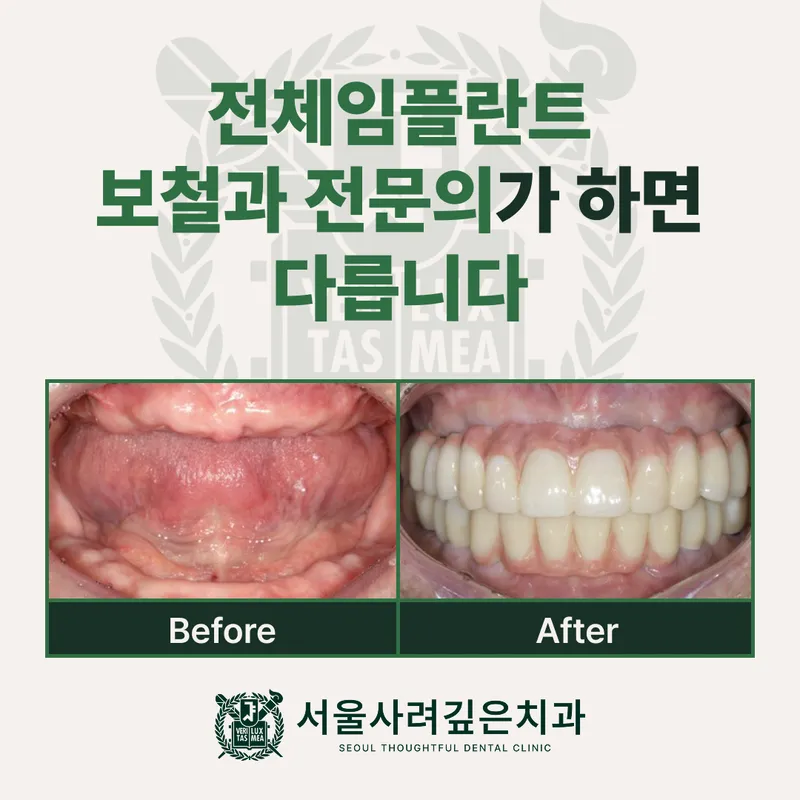 서울사려깊은치과의원 발산