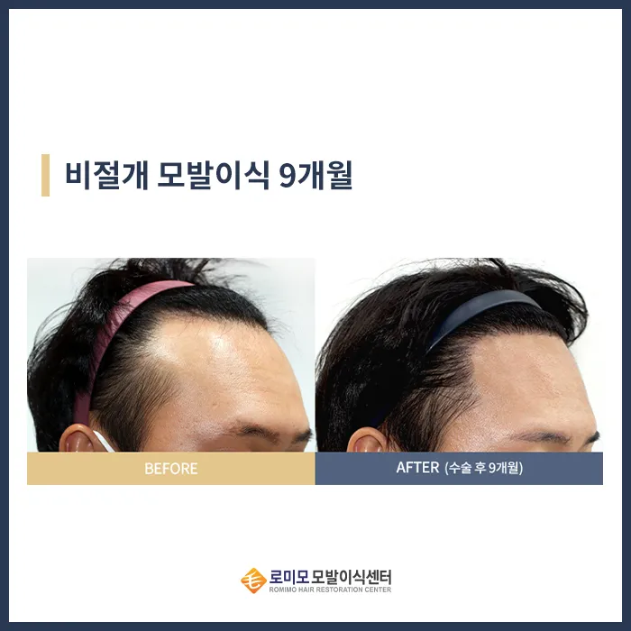 Gangnam Romyo Clinic