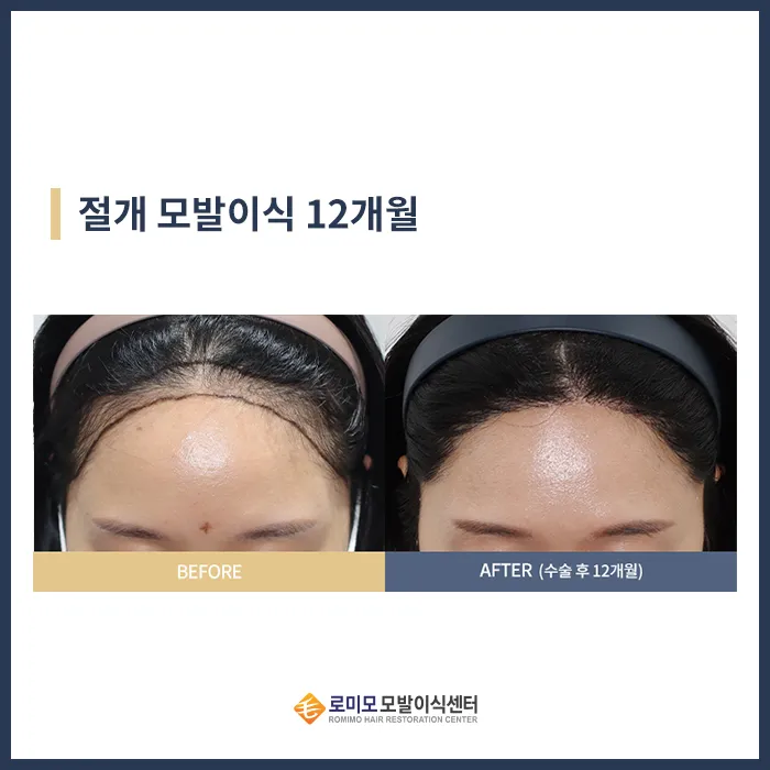 Gangnam Romyo Clinic