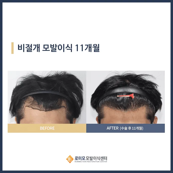 Gangnam Romyo Clinic