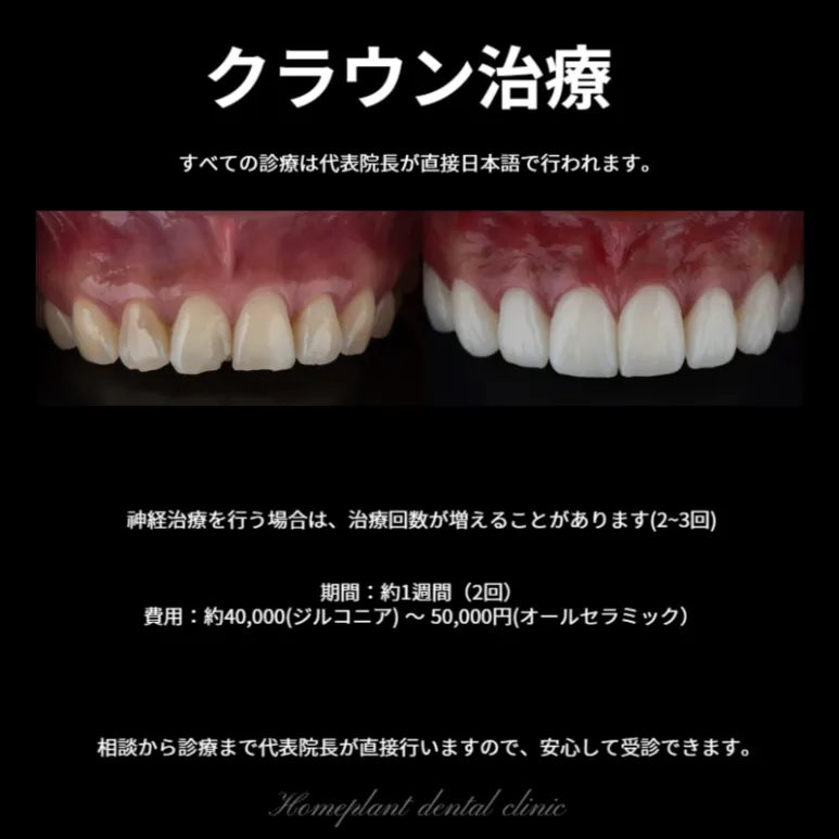 홈플란트치과의원