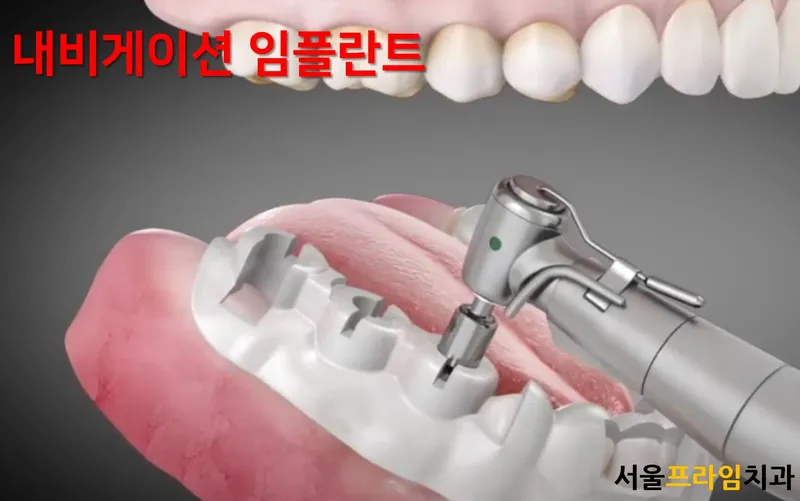 서울프라임치과의원
