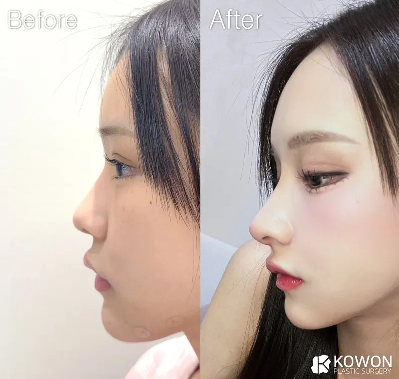 COWON Plastic Surgery Clinic