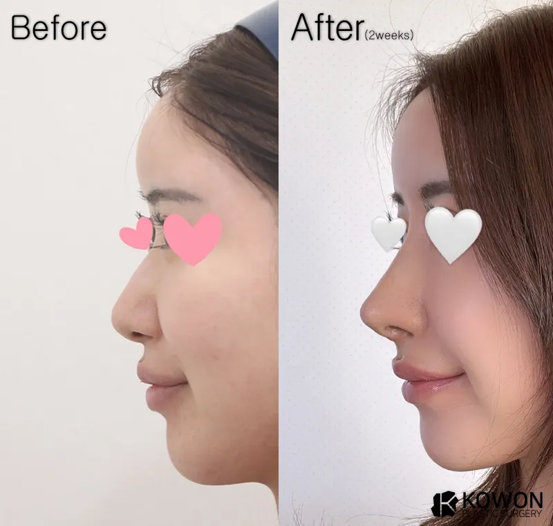 COWON Plastic Surgery Clinic