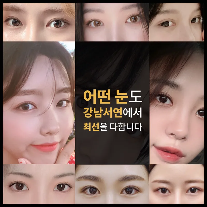 Gangnam Sowon Plastic Surgery Clinic