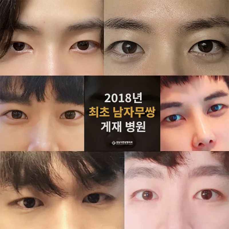 Gangnam Sowon Plastic Surgery Clinic