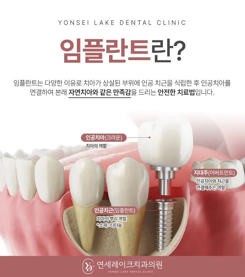 연세레이크치과의원 송파석촌