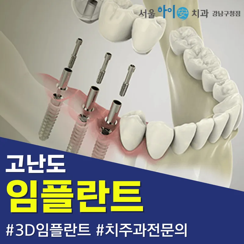 Seoul Hi An Dental Clinic Gangnam-gu Office