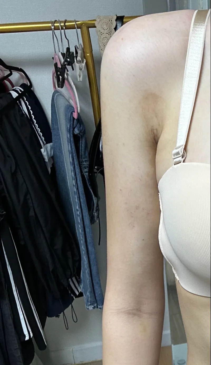 Model Line Clinic Gangnam Branch