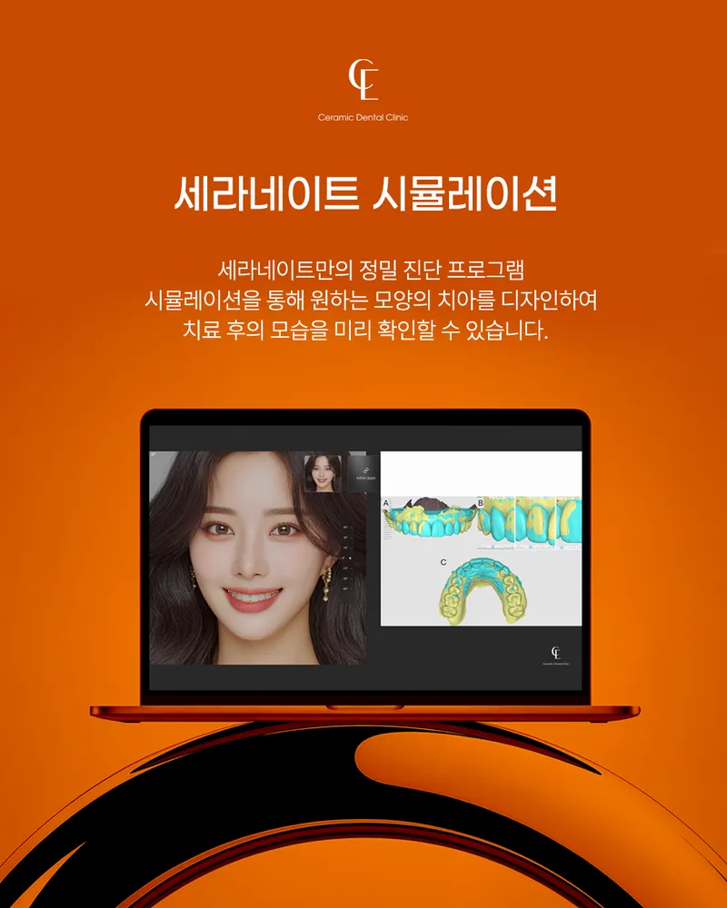 Ceramic Dental Clinic Gangnam