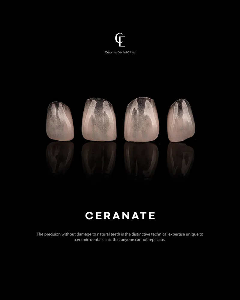 Ceramic Dental Clinic Gangnam