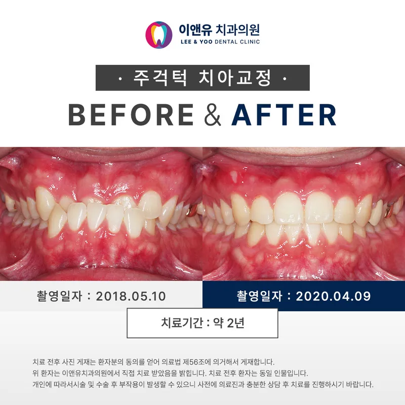 이앤유치과의원