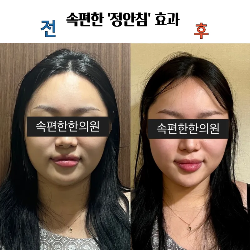 Sokpyeonhan Korean Medicine Clinic