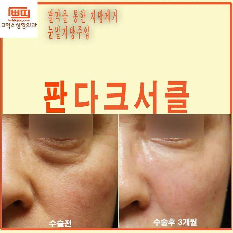 Go Ik Su Plastic Surgery Clinic