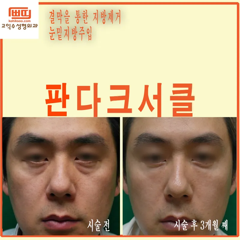 Go Ik Su Plastic Surgery Clinic