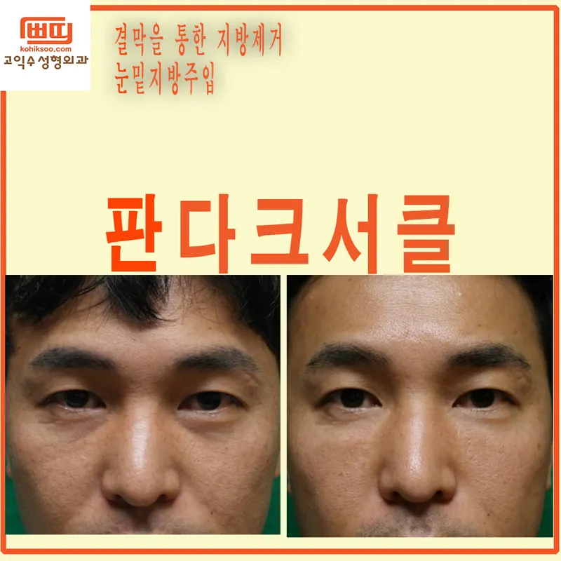 Go Ik Su Plastic Surgery Clinic