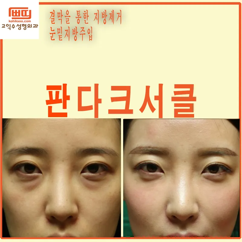 Go Ik Su Plastic Surgery Clinic